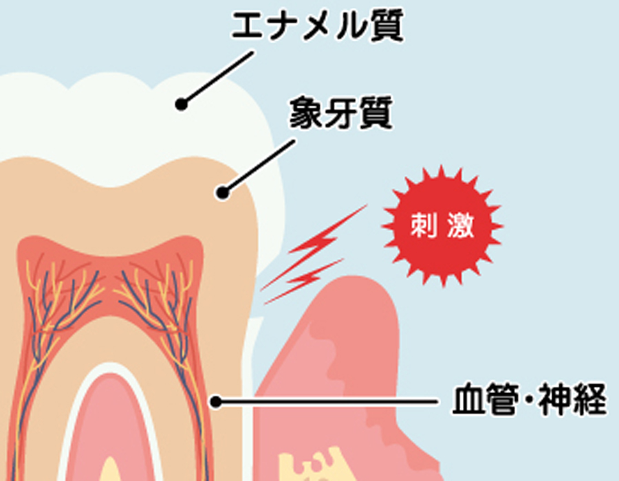 摂津市（千里丘）の歯医者、ひろ歯科の歯科用レーザー治療