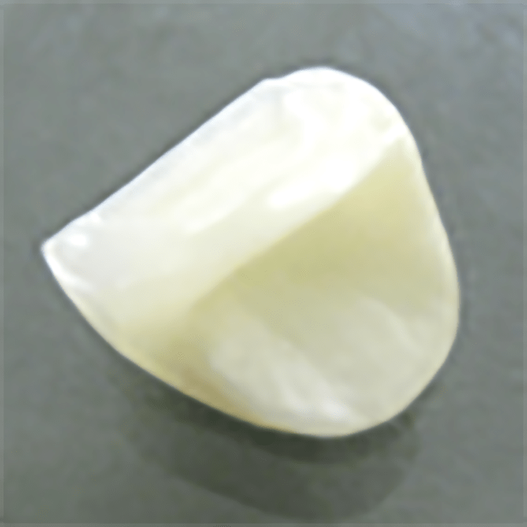 岡崎市の歯医者、ヒロデンタルオフィスの料金表
